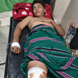 AKSI KEJAR-KEJARAN ANTAR PEMUDA DI DOMPU, DUA PELAJAR LUKA-LUKA