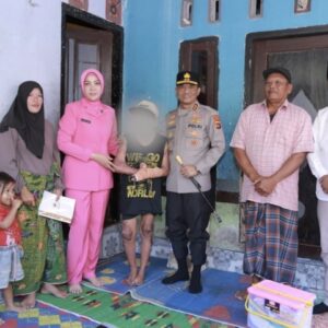 Kapolda NTB Jenguk Korban Tersulut Api di Ponpes di Lombok Tengah, Janji Kawal Restitusi dan Tuntaskan Kasus